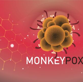 Destigmatizing Monkeypox Is an Important Part of Controlling This Outbreak